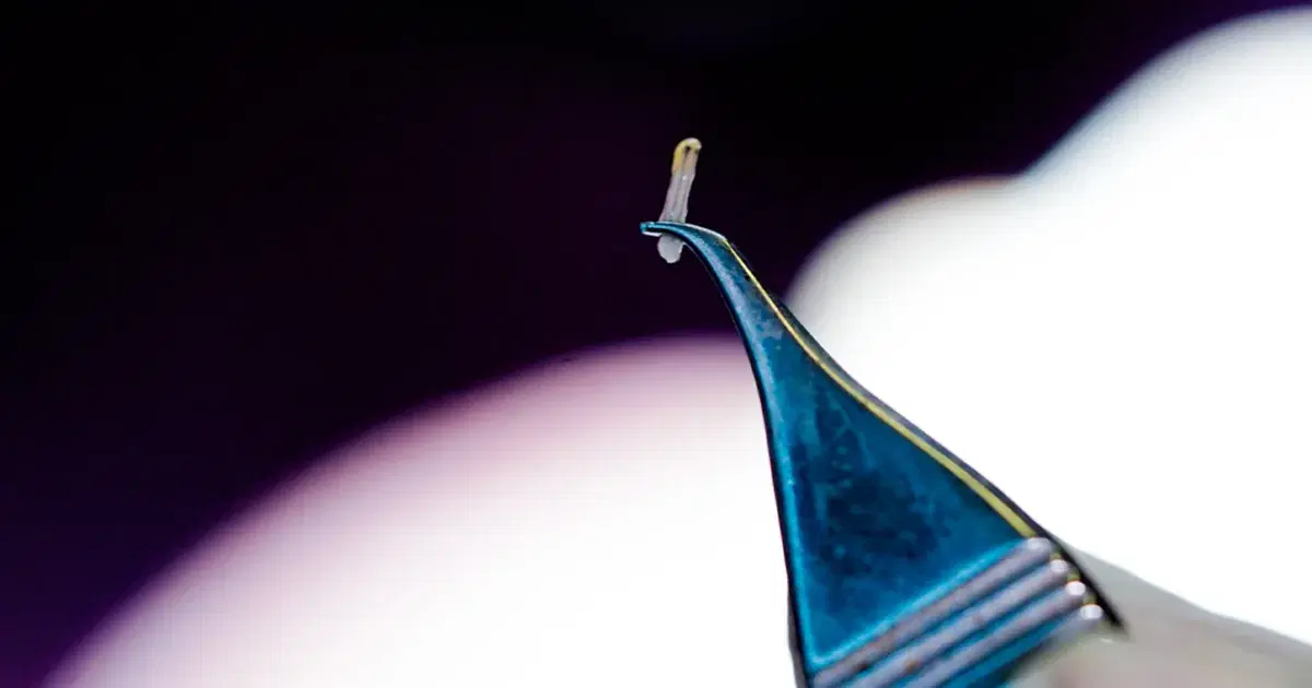 Hair Follicle: Structure, Function, and Treatments